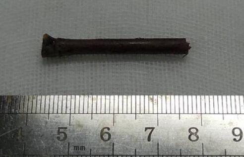 “小小竹棍把我害的好苦啊!幸好，遇到了厦门眼科中心眼整形科的胡继发副主任。医术好、态度好。大医院 医生就是不一样!”——医治眼睛后的老李激动的说道2.jpg