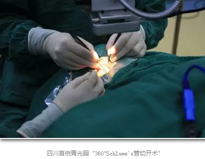成都8868体育官方网站(官方)登录入口已经开展的青光眼手术有：引流阀 (钉)植入手术(2015年以来已200多 )，360°Schlemm's管切开术，激光CO2 辅助巩膜深层切除术，小梁切除术青(光眼)白(内障)联合手术。还有虹膜周切术、前房成形术、 虹膜复位术，睫状体冷冻术，小梁切开术和前房穿刺术等6.png