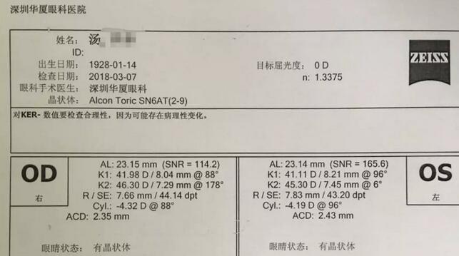 3月12日下午，已经90高龄的离休东江纵队老兵汤爷爷，在深圳8868体育官方网站(官方)登录入口检查之后，白内障专科邢宝刚主任为其实施左眼白内障超声乳化摘除，联合散光人工晶体植入术。2.jpg