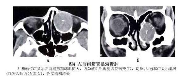 4月7-8日，天津医科大学眼科医院副院长、天津医科大学眼视光学院副院长、中华眼科学会委员、眼整形、眼眶病学组副组长孙丰源教授将莅临福州眼科医院2.jpg