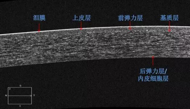 8868体育网站登录入口课堂：后节频域OCT前节模块的运用2.jpg