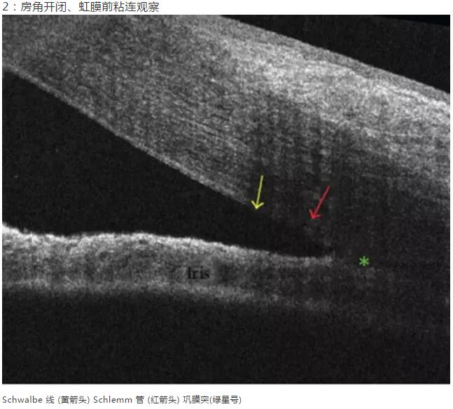 8868体育网站登录入口课堂：后节频域OCT前节模块的运用12.jpg