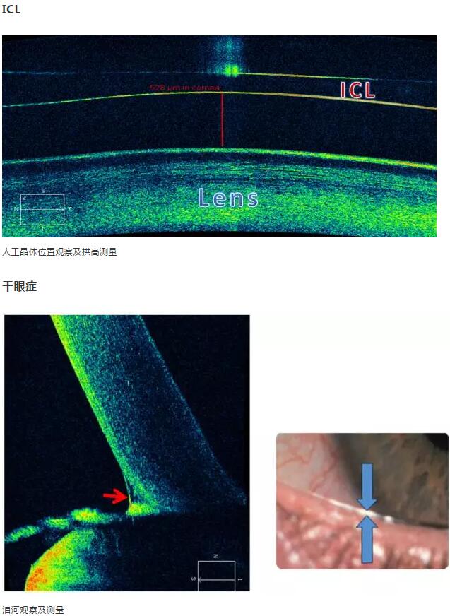 8868体育网站登录入口课堂：后节频域OCT前节模块的运用15.jpg