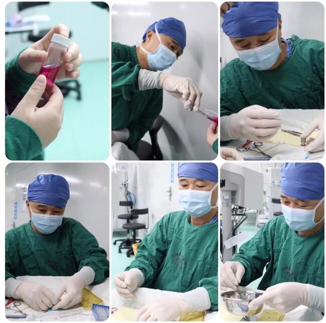 姚晓明教授来福州眼科医院，为解除角膜病患痛苦3.jpg