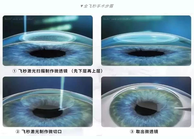 7月26日来深圳8868体育官方网站(官方)登录入口参与暑期摘镜季活动就可以有机会参与抽奖免单手术！2.png