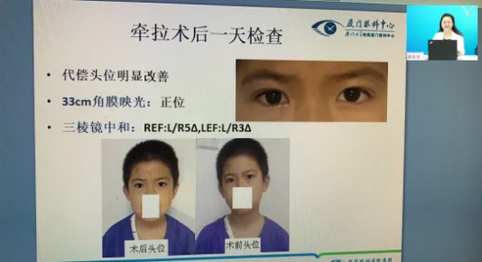 高峰论道·云端荟萃 ▏万人同步在线，30余名大咖云集“第六届8868体育网站登录入口论坛斜视与小儿眼科新技术学习班暨小儿、眼视光分论坛”7.png