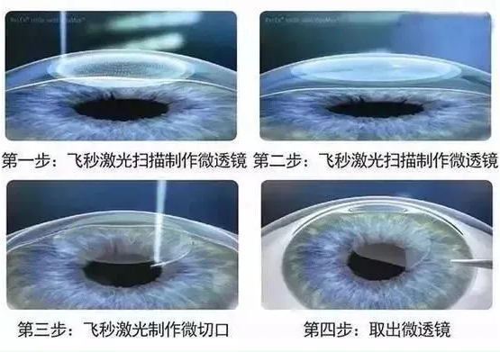 2021年征兵准备工作已经全面展开，视力不够的看过来2.png