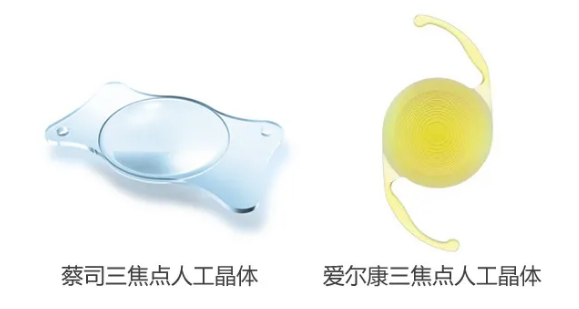 我看到了9个月亮，中国医生一招解决！“洋女婿”患白内障几近失明，在厦门眼科中心手术4.png
