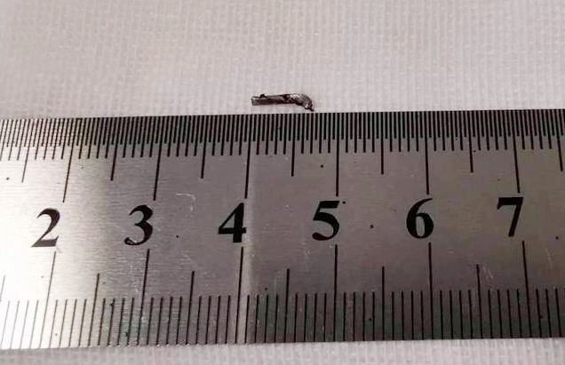 8868体育网站登录入口徐州复兴眼科王海菊：妙手拨迷障，匠心护光明3.png